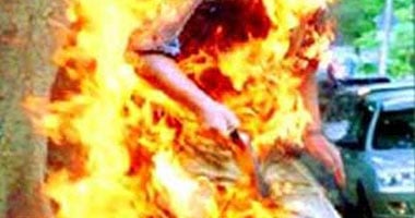 إصابة سيدة أشعل زوجها النار في جسدها بالفيوم