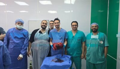 نجاح استئصال ورم نادر يزن أكثر من 30 كيلو لمريض بمعهد أورام جامعة المنوفية