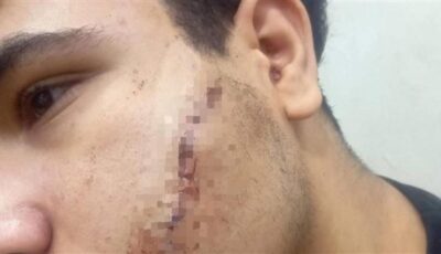 طالب يعتدي على زميله بسبب مشادة كلامية في شبرا الخيمة