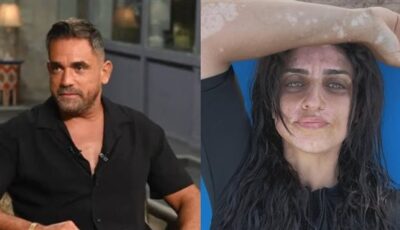 نسرين كرارة تعلن إصابتها بالبهاق.. وشقيقها يدعمها: مفيش في حلاوتك