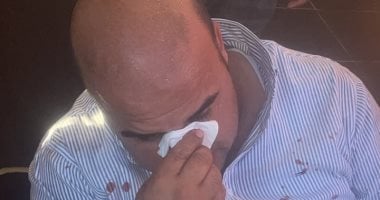 3 سيدات وبائع متجول.. تفاصيل واقعة التعدى على نائب رئيس مدينة رأس البر