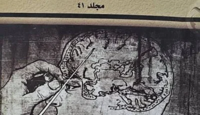رحلة في الطب المصري البطلمي