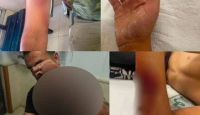 تفاصيل مفزعة وإصابات متفاوتة.. كلب ضال يعقر 12 شخصاً ويثير الهلع في الأردن