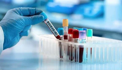 الدواء الأمريكية توافق على اختبار للكشف عن سرطان القولون.. هل يُغني عن المنظار؟